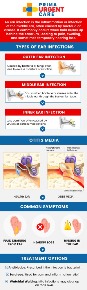 Ear infections can cause significant pain and discomfort, and timely treatment is essential for relief. At Prima Urgent Care, our healthcare professionals provide fast and effective ear infection treatment. Whether it’s caused by bacteria, a virus, or fluid buildup, we offer accurate diagnoses and tailored treatment plans to help you recover quickly and comfortably. For more information, contact us today or book an appointment online. We are conveniently located at 3903 Fair Ridge Dr Suite Q, Fairfax, VA 22033. Ear infections can cause significant pain and discomfort, and timely treatment is essential for relief. At Prima Urgent Care, our healthcare professionals provide fast and effective ear infection treatment. Whether it’s caused by bacteria, a virus, or fluid buildup, we offer accurate diagnoses and tailored treatment plans to help you recover quickly and comfortably. For more information, contact us today or book an appointment online. We are conveniently located at 3903 Fair Ridge Dr Suite Q, Fairfax, VA 22033.