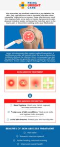 Abscess Healing Stages – What to Expect During Recovery