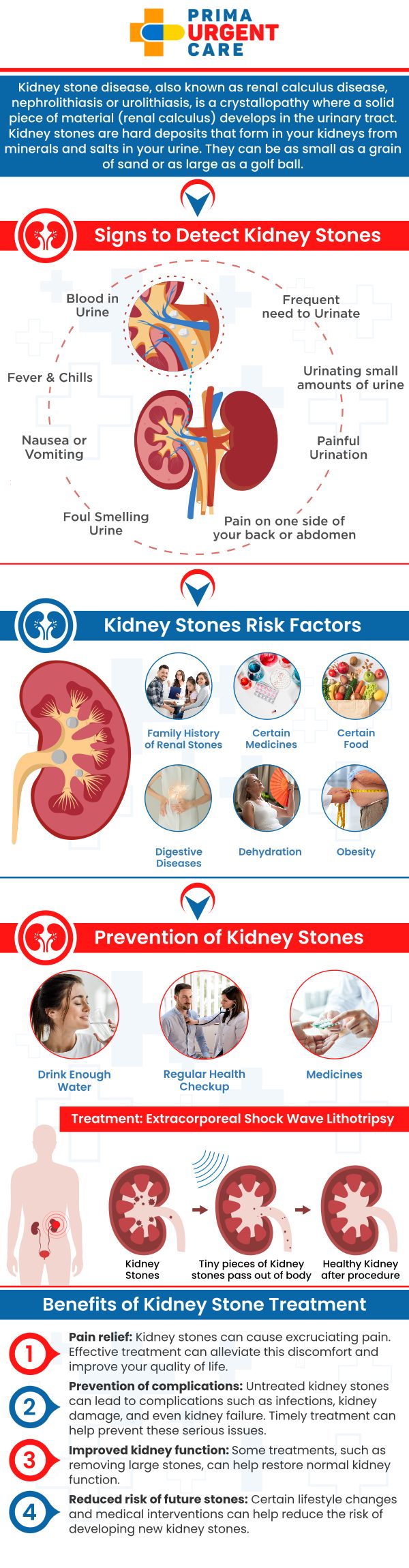 If you're experiencing symptoms of kidney stones, such as severe pain in your back or abdomen, blood in your urine, or difficulty urinating, urgent care is essential to manage pain and prevent complications. At Prima Urgent Care in Fairfax, VA, Susane Njomo and our team provide quick and effective treatment for kidney stones. We offer advanced diagnostic tools and personalized care to help alleviate discomfort and promote faster recovery. Trust our team to deliver reliable, compassionate care when you need it most. For more information contact us to schedule an appointment online. We are conveniently located at 3903 Fair Ridge Dr Suite Q, Fairfax, VA 22033.
