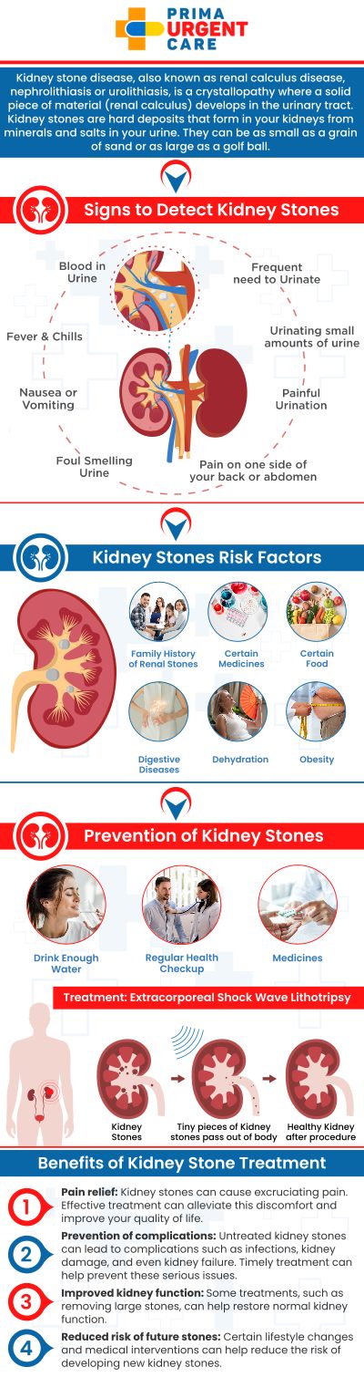 If you're experiencing symptoms of kidney stones, such as severe pain in your back or abdomen, blood in your urine, or difficulty urinating, urgent care is essential to manage pain and prevent complications. At Prima Urgent Care in Fairfax, VA, Susane Njomo and our team provide quick and effective treatment for kidney stones. We offer advanced diagnostic tools and personalized care to help alleviate discomfort and promote faster recovery. Trust our team to deliver reliable, compassionate care when you need it most. For more information contact us to schedule an appointment online. We are conveniently located at 3903 Fair Ridge Dr Suite Q, Fairfax, VA 22033.