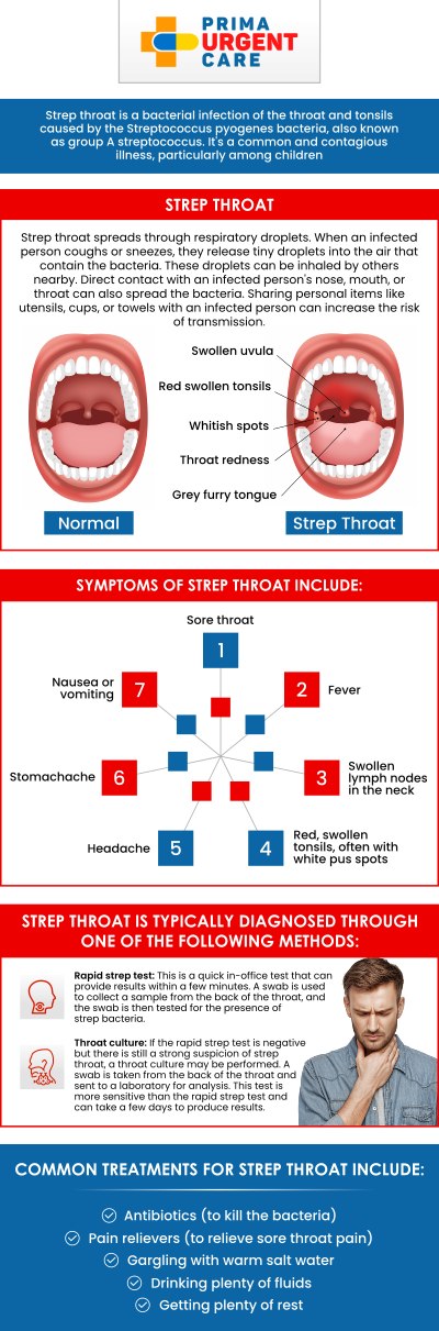 If you're seeking an accurate strep test without insurance, Prima Urgent Care in Fairfax, VA, offers an affordable and timely solution. The cost of a strep test may vary based on your specific needs, but we provide transparent pricing to ensure you understand all charges upfront. The cost of a strep test without insurance in Fairfax, VA typically ranges from $50 to $150, depending on the specific needs of the patient. Our experienced medical team is here to guide you through the process, offering compassionate care in a comfortable setting, ensuring you're back on the path to recovery. For more information, contact us today or book an appointment online. We are conveniently located at 3903 Fair Ridge Dr Suite Q, Fairfax, VA 22033.
