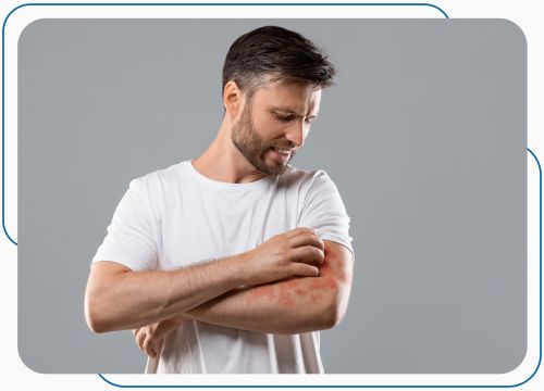 Allergies Treatment at Prima Urgent Care in Fairfax, VA