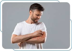 Allergies Treatment at Prima Urgent Care in Fairfax, VA