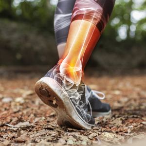 Ankle Sprain Treatment Near Me in Fairfax, VA 