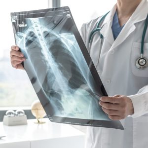X-Rays Services Near Me in Fairfax, VA