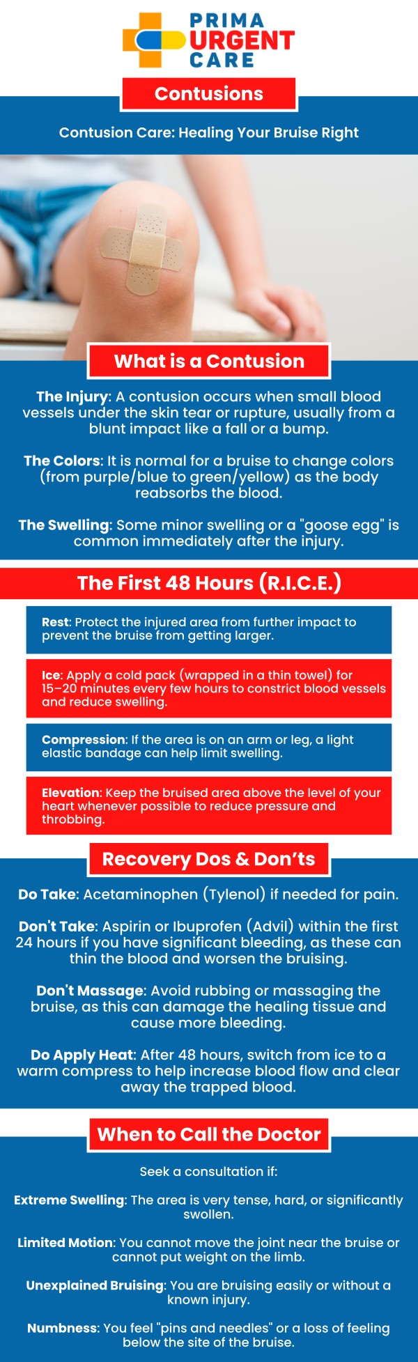 Common Questions Asked by Patients: What is the difference between a contusion and a bruise? Is a contusion a serious injury? What are the 3 types of contusions?

Contusions, or bruises, occur when blood vessels under the skin are damaged, leading to swelling, pain, and discoloration. At Prima Urgent Care, our medical team provides prompt treatment for contusions, focusing on pain relief and reducing swelling. Treatment may include ice application, elevation, and over-the-counter medications to manage discomfort. In some cases, further evaluation is provided to rule out more serious injuries, ensuring the best care for a quick recovery. For more information, contact us today or book an appointment online. We are conveniently located at 3903 Fair Ridge Dr Suite Q, Fairfax, VA 22033. We serve patients from Fairfax VA, South Riding VA, Dulles VA, Chantilly VA, Stone Ridge VA, Oakton VA, Legato VA, Burke VA, Oak Hill, Lees Corner VA & BEYOND! Our Fairfax location is close to Fair Oaks Hospital, Fair Oaks Mall, and Greenbriar Shopping Center.