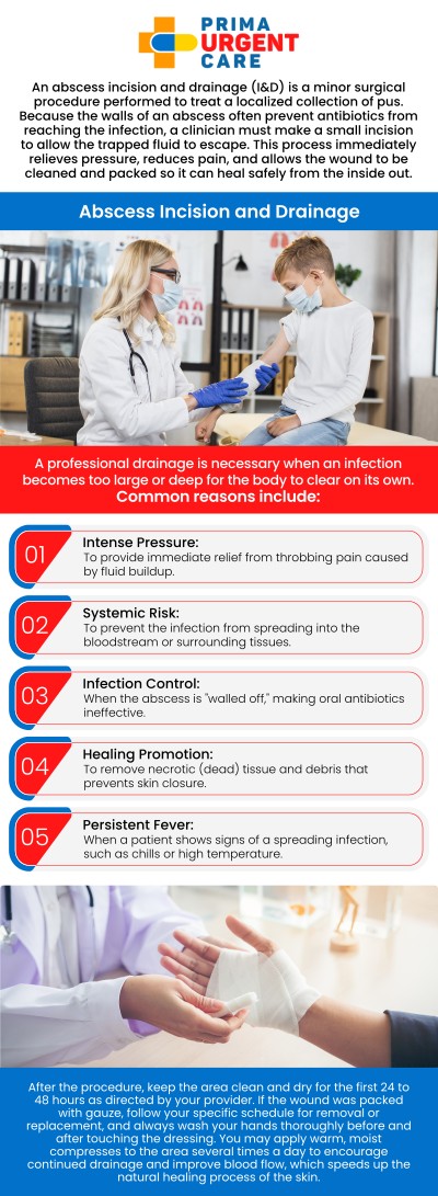 Knowing what to expect after an abscess drainage is crucial for ensuring a smooth, infection-free recovery. It is completely normal to experience mild swelling, tenderness, and continued fluid drainage for the first few days following your procedure. Keeping the wound clean, changing your dressings regularly, and following specific packing instructions are vital steps to help the cavity heal properly from the inside out. Our dedicated medical team at Prima Urgent Care in Fairfax, VA, is here to provide personalized aftercare guidance and prompt follow-up visits to support your complete healing. For more information, contact us or book an appointment online. We are conveniently located at 3903 Fair Ridge Dr Suite Q, Fairfax, VA 22033.