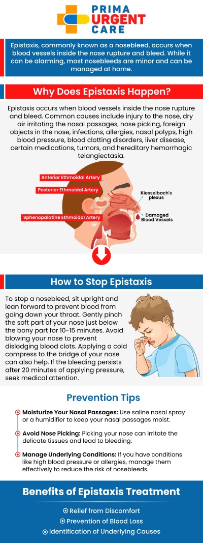 Common questions asked by patients: What is epistaxis, and what are the most common causes of nosebleeds? What symptoms indicate the need for professional nosebleed treatment? Why do some people experience frequent or recurring nosebleeds? When should you visit an urgent care clinic for a nosebleed? 
At Prima Urgent Care, our professional team provides individualized evaluation and treatment for patients experiencing frequent, persistent, or unexpected nosebleeds in Fairfax, VA. We focus on identifying potential causes, including nasal dryness, irritation, allergies, or underlying health concerns. Our clinic carefully assesses each patient's symptoms, medical history, and the frequency of nosebleeds to determine an appropriate care plan. Whether a nosebleed occurs occasionally or repeatedly, our team emphasizes timely attention, patient comfort, and practical guidance to help manage symptoms and reduce the likelihood of recurrence. For more information, contact us or book an appointment online. We are conveniently located at 3903 Fair Ridge Dr Suite Q, Fairfax, VA 22033. We serve patients from Fairfax VA, South Riding VA, Dulles VA, Chantilly VA, Stone Ridge VA, Oakton VA, Legato VA, Burke VA, Oak Hill, Lees Corner VA & BEYOND! Our Fairfax location is close to Fair Oaks Hospital, Fair Oaks Mall, and Greenbriar Shopping Center.