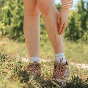 Lyme Disease Evaluation & Testing Clinic in Fairfax, VA